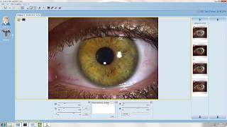 Capturing Images  EyeSuite Software [upl. by Fleta]