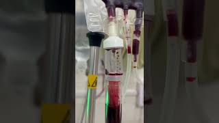 Blood transfusion dialysis bloodtransfusion dialysis shortvideo doctor hospitalmedicine [upl. by Lyrahs]