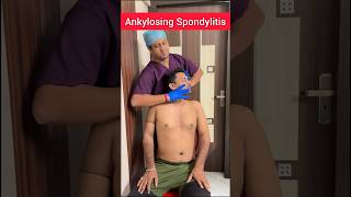 The Expert Treatment to Ankylosing spondylitis PTAnindya [upl. by Nivlad]