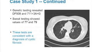 Management Strategies for Adults with Cystic Fibrosis [upl. by Dammahum]