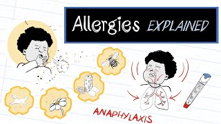 What are Allergies HealthSketch [upl. by Eednas]