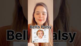 Sign n Symptoms of Bell’s Palsy nervousdisoreder newlearning medicolearners newlearning yt [upl. by Leunam941]