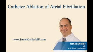 Catheter Ablation of Atrial Fibrillation [upl. by Casandra]