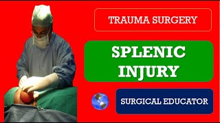 SPLENIC INJURY  How to DIAGNOSE amp TREATBlunt Injury Abdomen  Trauma Surgery [upl. by Sapphire]