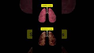 Healthy Lungs VS Smokers Lungs human health smoke [upl. by Grubb]