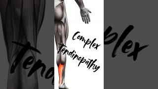 letstalkabout complex tendinopathy sports sportsmedicine sportsdoctor sportsinjury fyp [upl. by Shulman641]