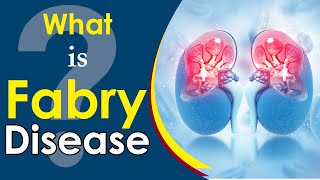 Karma Ayurveda explains Fabry disease  Karma Ayurveda Hospital [upl. by Menell]