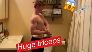 15 YEAR OLD WITH HUGE TRICEPS 😱 [upl. by Tomkiel]