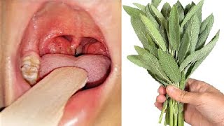 Cuts Cough Like a Knife 💯 Expectorant 😷 Natural Antibiotic for Bronchitis and Pharyngitis ❗ Liver [upl. by Ettelracs]