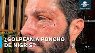 Poncho de Nigris aparece golpeado y sorprende a usuarios en redes [upl. by Nauqas]