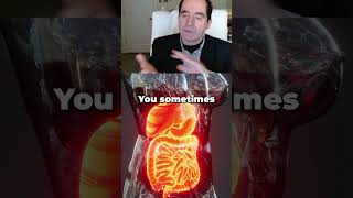 What causes diverticulitis [upl. by Reviel725]