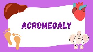 Acromegaly  Causes Symptoms Diagnosis Treatment  Endocrinology [upl. by Lorrad210]