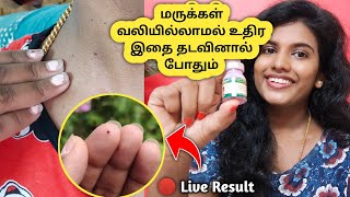 ♦️₹ 80 செலவில் மருக்கள் உதிரும்💯How to remove warts ➡️ Remove skin warts  home 🔥 Effective remedy 😱 [upl. by Gine316]