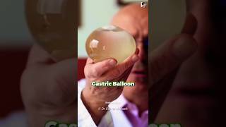 Gastric weight loss balloon [upl. by Walden]