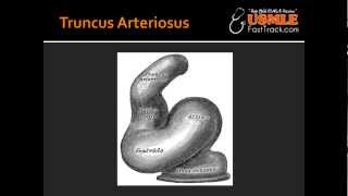 Truncus Arteriosus [upl. by Einned]