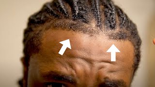 How To Get The Perfect Front Taper Hairline Side Taper amp Back Taper  Braids Dreads Twist amp Afro [upl. by Paxton]