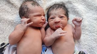 Cutest Twins Newborn babies just after birth where Boy is fed up with the Girl Drama love baby [upl. by Aicenert]