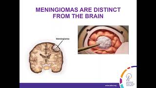 WEBINAR Treatment Strategies for Meningioma [upl. by Edecrem997]