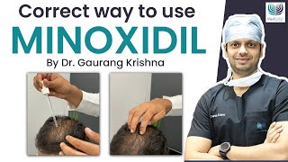 Correct Way to Use Minoxidil in 2024 Types of Minoxidil  Minoxidil Results  Medlinks [upl. by Ecnerwal]