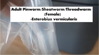 Adult Pinworm Demonstration [upl. by Esinehc]