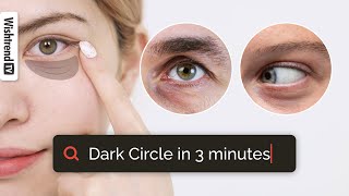 How To Get Rid Of Dark Circles👁️  Treatment  SelfCare Tips👍 [upl. by Kittie]