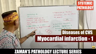 Systemic Pathology Lecture 35  Diseases of CVS  Day 05  Myocardial infarction  01 [upl. by Gilberto256]