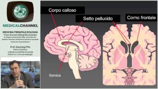 Ecoencefalografia Fetale  Corso Avanzato Esclusiva [upl. by Ardnahcal653]