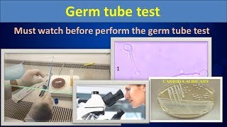 Germ tube testsimply describe procedure [upl. by Onailime]