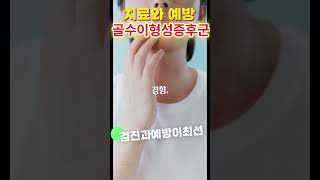 골수이형성증후군증상 골수암 급성으로 진행될 수 있다 [upl. by Onil304]