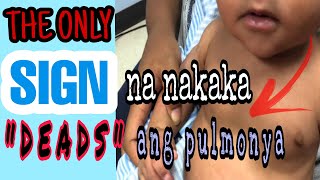 PULMONYA SA BATA ang nakakatakot na senyales na nakakamatay ang UBO at mabilis na paghinga [upl. by Wessling]