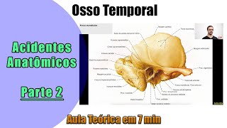 Osso Temporal  Aula Teórica  Parte 2  Anatomia Humana [upl. by Anauqes]