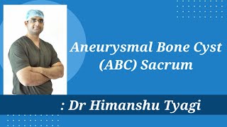 Aneurysmal Bone Cyst ABC Sacrum  TreatmentSurgery [upl. by Dace]