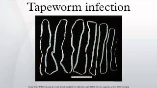 Tapeworm infection [upl. by Elijah]