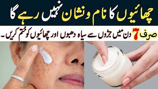 صرف 7 دنوں میں جھائیوں سے نجات پائیں I Reduce Melasma I Pigmentation I Discolouration I Blackspots [upl. by Backer]