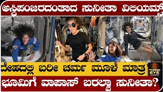 ಅಸ್ಥಿಪಂಜರದಂತಾದ ಸುನೀತಾ ವಿಲಿಯಮ್ಸ್ ಭೂಮಿಗೆ ವಾಪಾಸ್ ಬರಲ್ವಾ ಸುನೀತಾ Sunita Williams Health update [upl. by Amalie805]