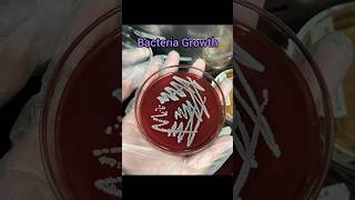 Culture plate streaking  Blood agar plate medicallaboratory medicalmicrobiology ytshorts [upl. by Atalanta]