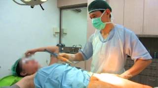 Liposuction with DrArthur [upl. by Ahsaf]