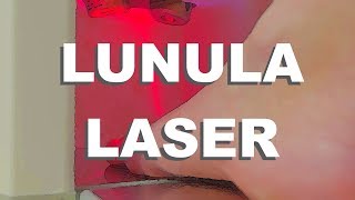 Lunula Laser  Fungal Infection Removal With Lasers [upl. by Laertnom]