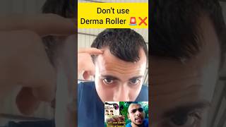 Derma Roller Hair Regrowth  How to use Derma Roller on hair dermaroller dermatology hairgrowth [upl. by Nnylaj]