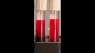 Preventing Hemolysis in the Blood Samples You Draw [upl. by Aihsakal976]