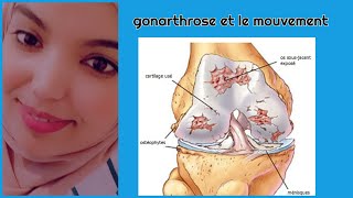 la gonarthrose et le mouvement [upl. by Macmillan]