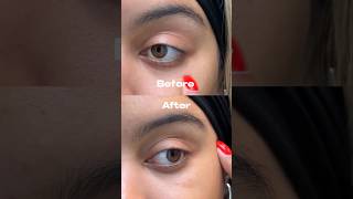 The before and after using the NEW peptide fine line eye gel from Cocokind is INSANEEE🤯 skincare [upl. by Galvan]