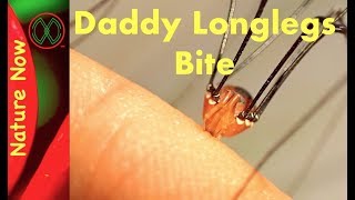 Daddy Long Legs  Myth or Legend [upl. by Llenrahs367]