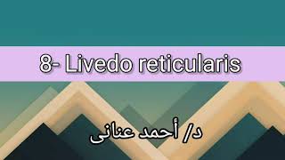 8 Livedo reticularis 👉 Dr Ahmed Anany [upl. by Yssej420]