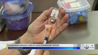 2 students at Spencerport school contact measles [upl. by Ahseikan40]