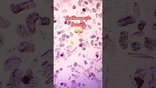 Cardiomyocyte dancing 😜shorts scienceexperiment scienceshorts cardiomyocyte cardiactechnology [upl. by Vorfeld443]