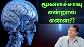 மூளைச் சாவு என்றால் என்ன examination in detailmedical awareness in Tamil [upl. by Ykcim666]