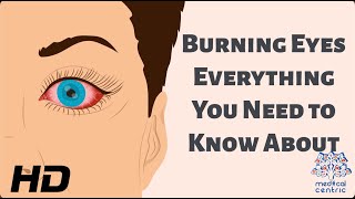 Burning Eyes Everything You Need to Know [upl. by Erdnaek]