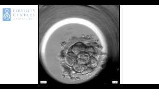 PreImplantation Embryo from Fertilization [upl. by Aramois]