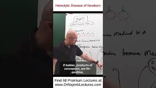 Hemolytic Disease of Newborn drnajeeb drnajeeb drnajeeblectures shorts [upl. by Soinski]